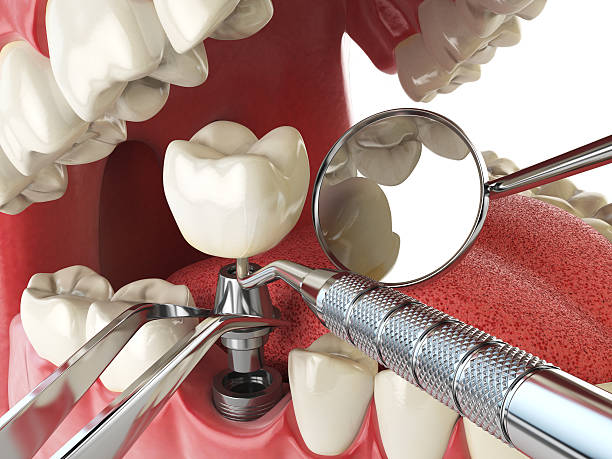 Best Emergency Dental Care for Broken or Chipped Teeth in Ravenswood, WV